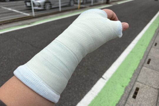 左手・手のひらを骨折